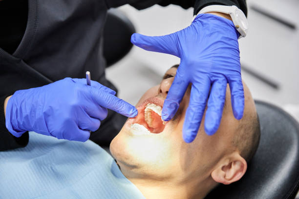 Best Urgent Care for Lost Fillings or Crowns in Belmont, VA